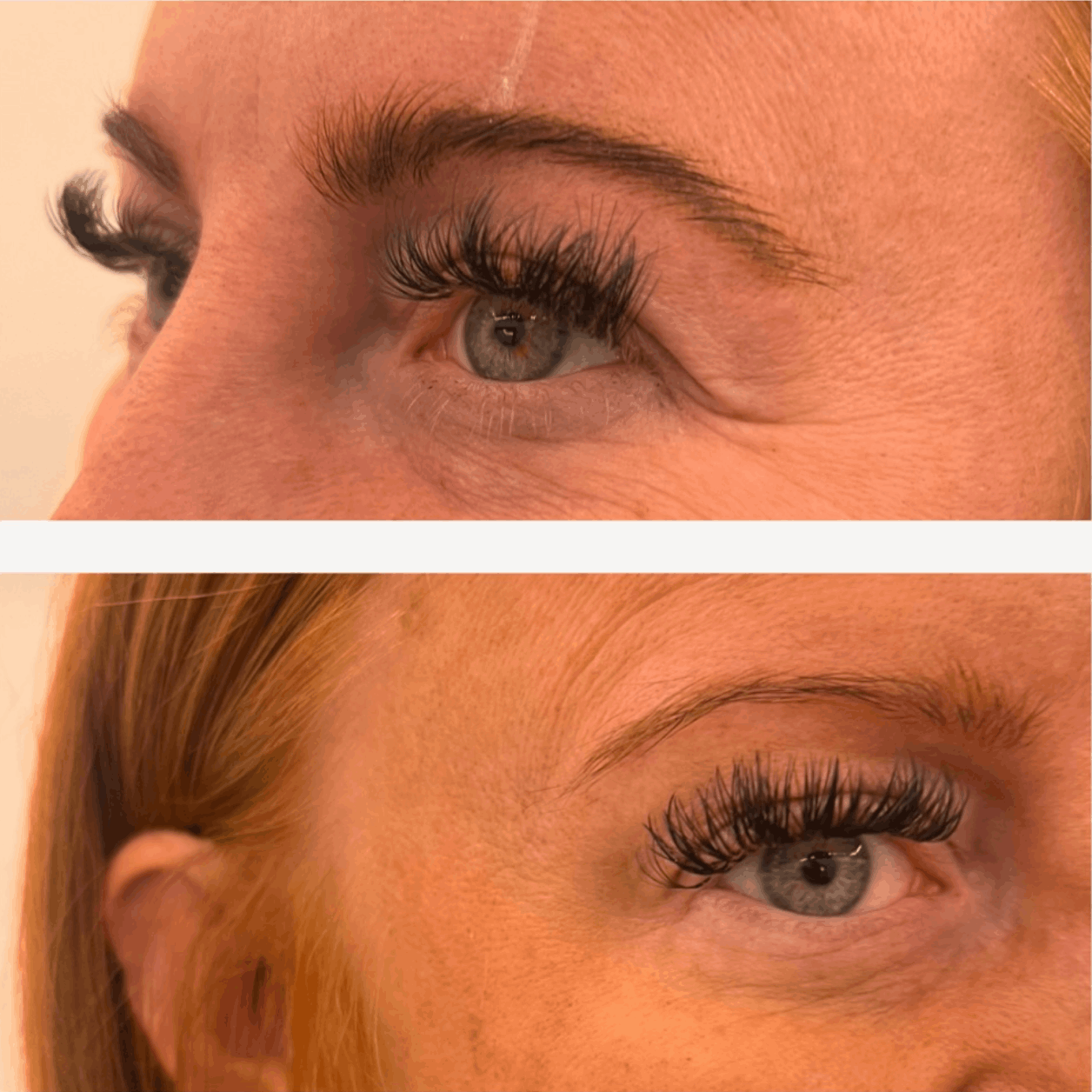 anti wrinkle vivid beauty